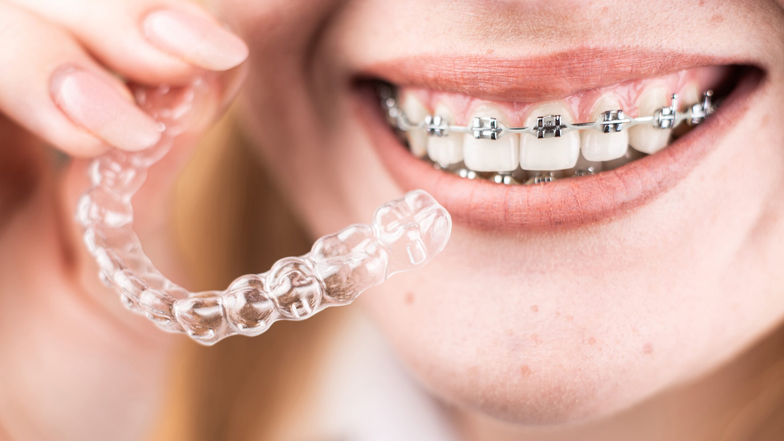 Hybrid Aligners