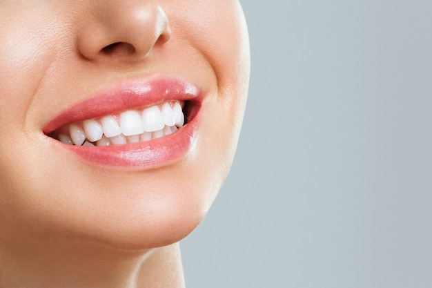 Zirconia Veneers